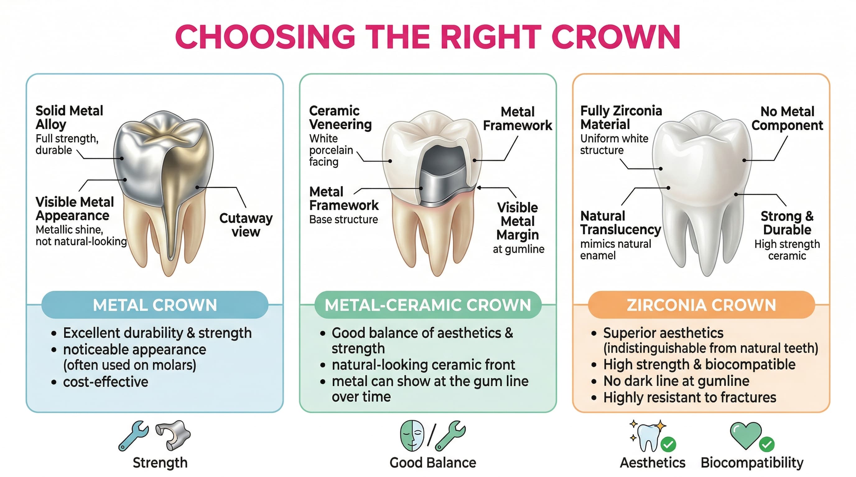 Crown material comparison infographic