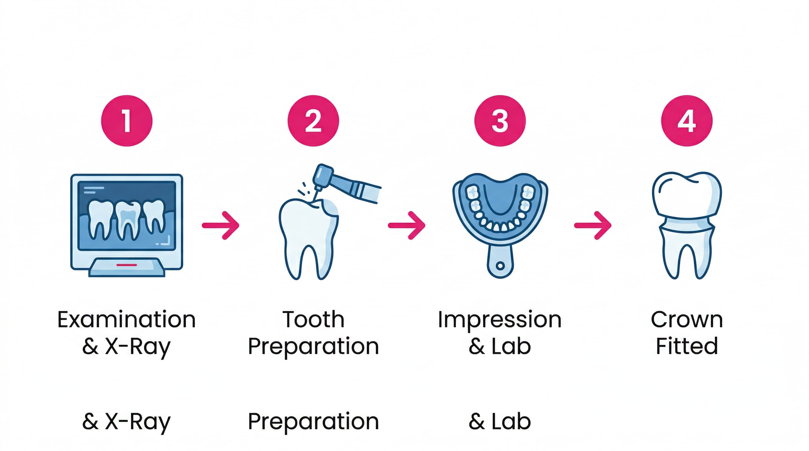 Crown process steps infographic